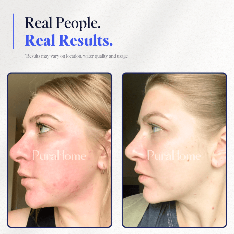 PuraHome™ Premium In-line Shower & Bath Filter